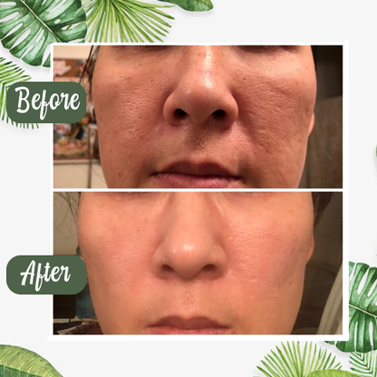 🔥【OFFICIAL STORE】Hot Sale - Green Tea Deep Cleanse Mask