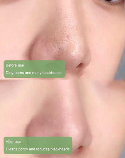 🔥【OFFICIAL STORE】Hot Sale - Green Tea Deep Cleanse Mask