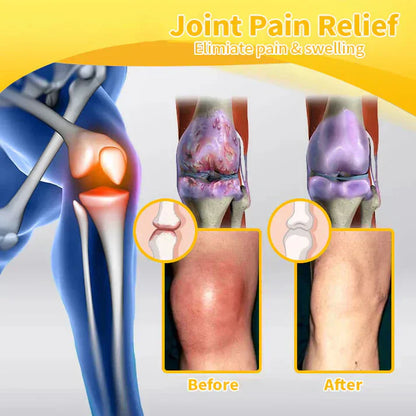 🐝TAILEDEN™ Bee Venom Joint Repair Gel👨‍⚕️Approved by the Australian Orthopedic Association (AOA)