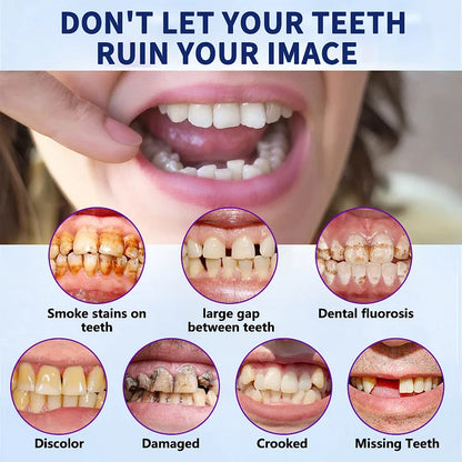 Official Store: QlAWI™Adsorptive denture(Limited time discountlast 30 minutes