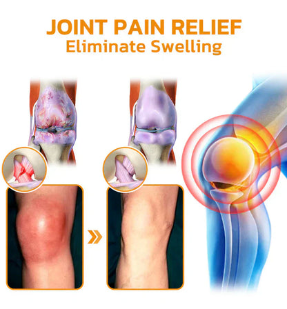 🐝TAILEDEN™ Bee Venom Joint Repair Gel👨‍⚕️Approved by the Australian Orthopedic Association (AOA)