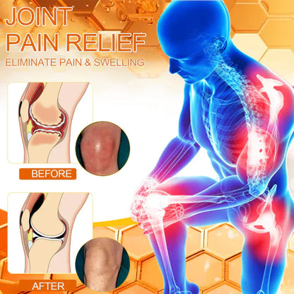🐝TAILEDEN™ Bee Venom Joint Repair Gel👨‍⚕️Approved by the Australian Orthopedic Association (AOA)