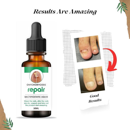 Nail Repair Serum