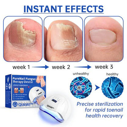 QIAWI™ PureNail Fungus Laser Device-✨Last Day Discount -𝟕0%𝐎𝐅𝐅 Made and Shipped from USA