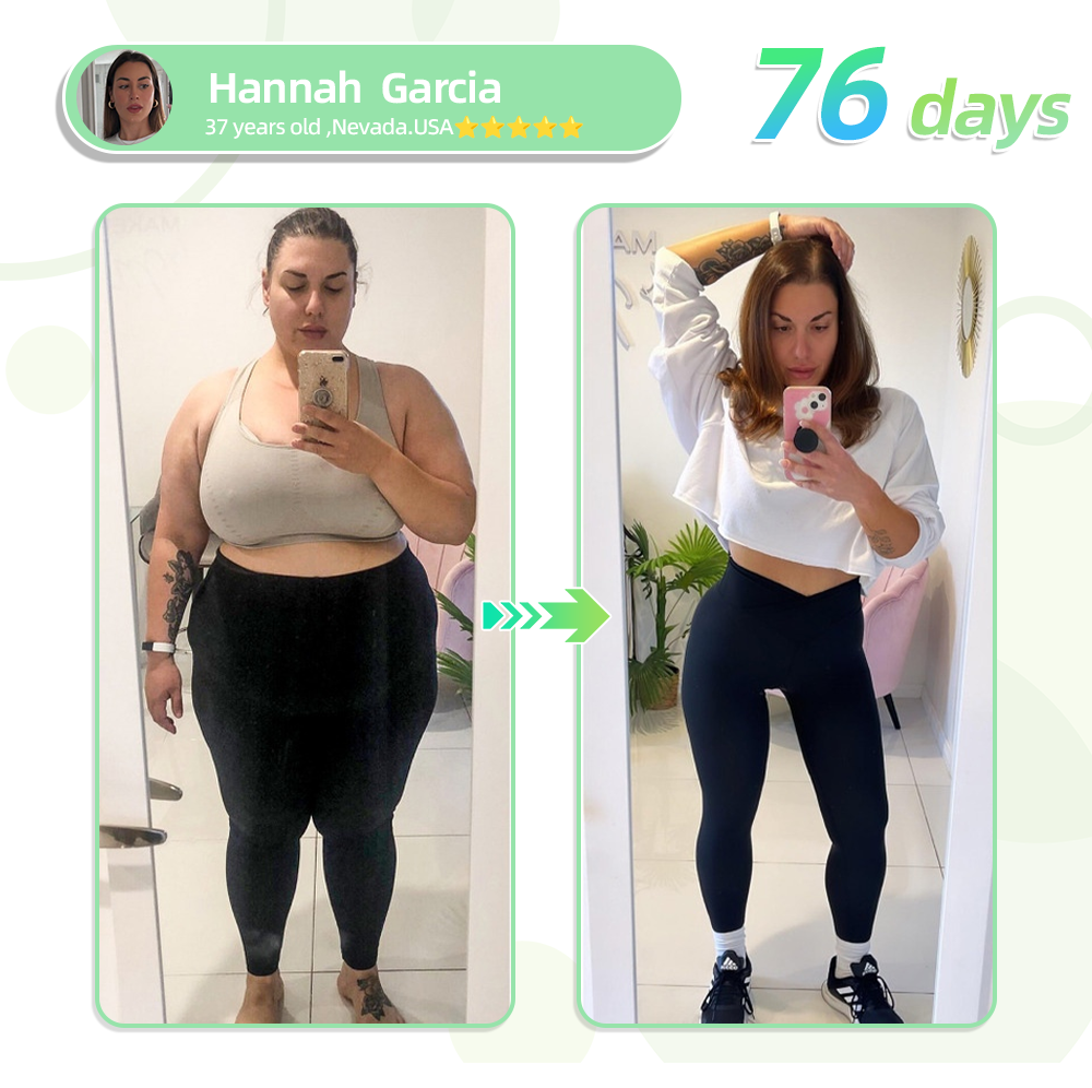 SMGT-GLP-1 Nano Microneedle lose weight Patch👩‍⚕️