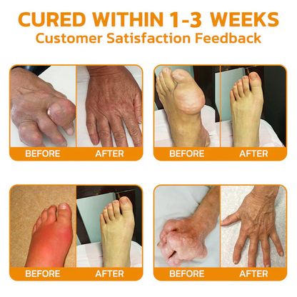 🐝TAILEDEN™ Bee Venom Joint Repair Gel👨‍⚕️Approved by the Australian Orthopedic Association (AOA)