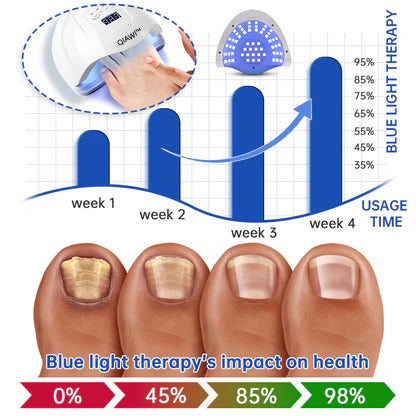 QIAWI™ PureNail Fungus Laser Device-✨Last Day Discount -𝟕0%𝐎𝐅𝐅 Made and Shipped from USA
