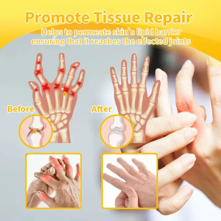 🐝TAILEDEN™ Bee Venom Joint Repair Gel👨‍⚕️Approved by the Australian Orthopedic Association (AOA)