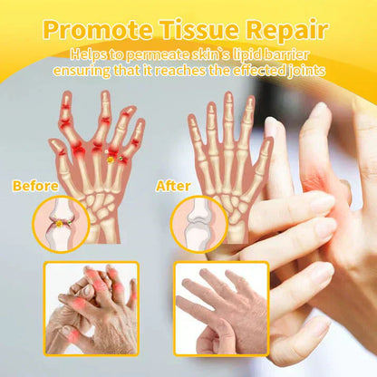 🐝TAILEDEN™ Bee Venom Joint Repair Gel👨‍⚕️Approved by the Australian Orthopedic Association (AOA)