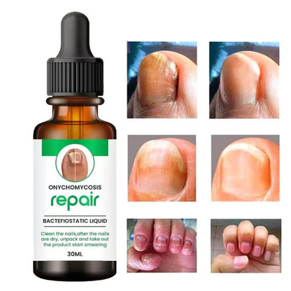 Nail Repair Serum