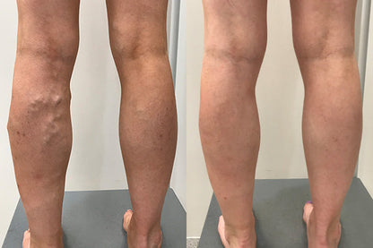 🔥Last 4 Hours 70% OFF✨AQA™ Vein Guard Herbal Spray