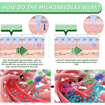 SMGT-GLP-1 Nano Microneedle lose weight Patch👩‍⚕️