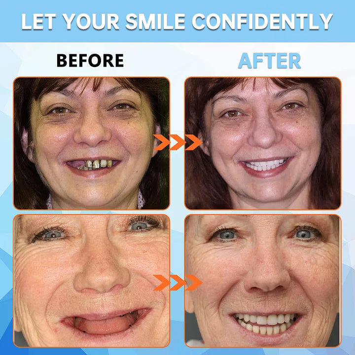 Official Store: QlAWI™Adsorptive denture(Limited time discountlast 30 minutes